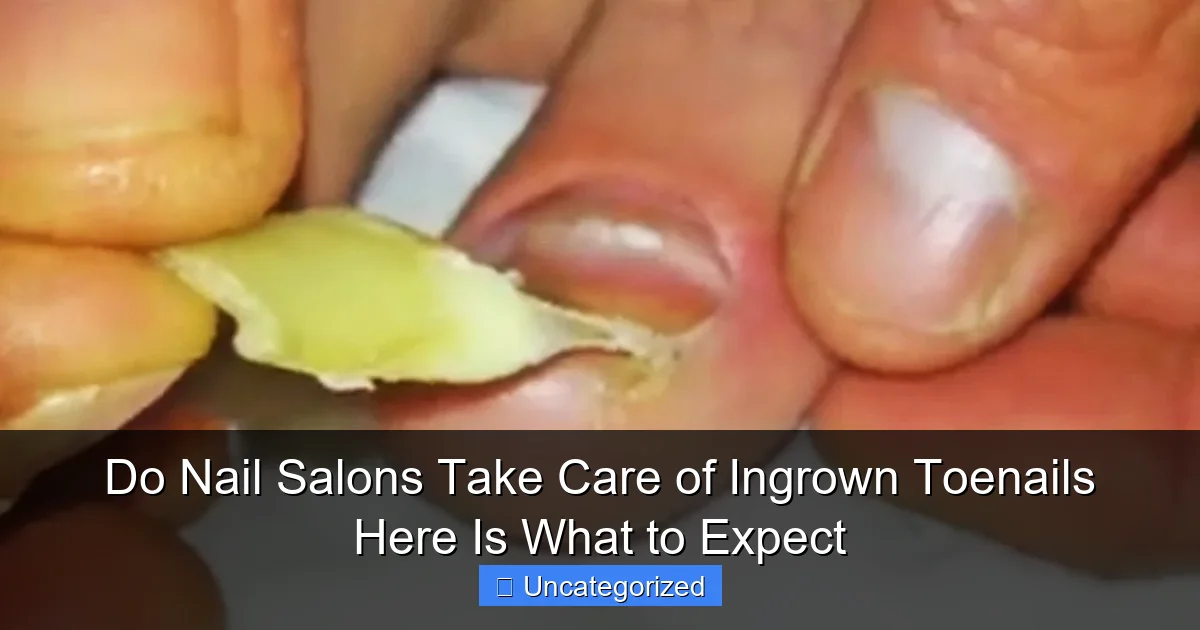 Do Nail Salons Take Care of Ingrown Toenails Here Is What to Expect