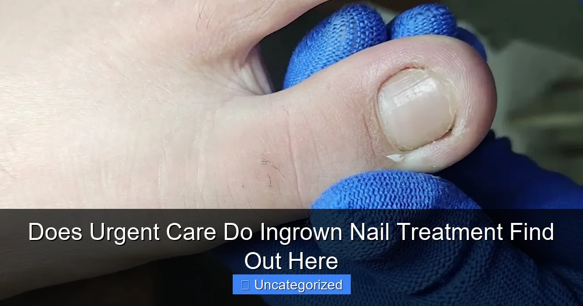 Does Urgent Care Do Ingrown Nail Treatment Find Out Here