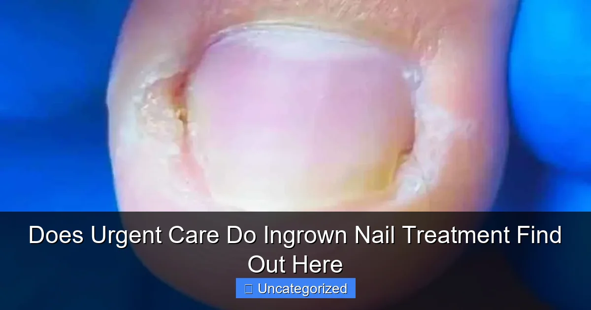 Does Urgent Care Do Ingrown Nail Treatment Find Out Here