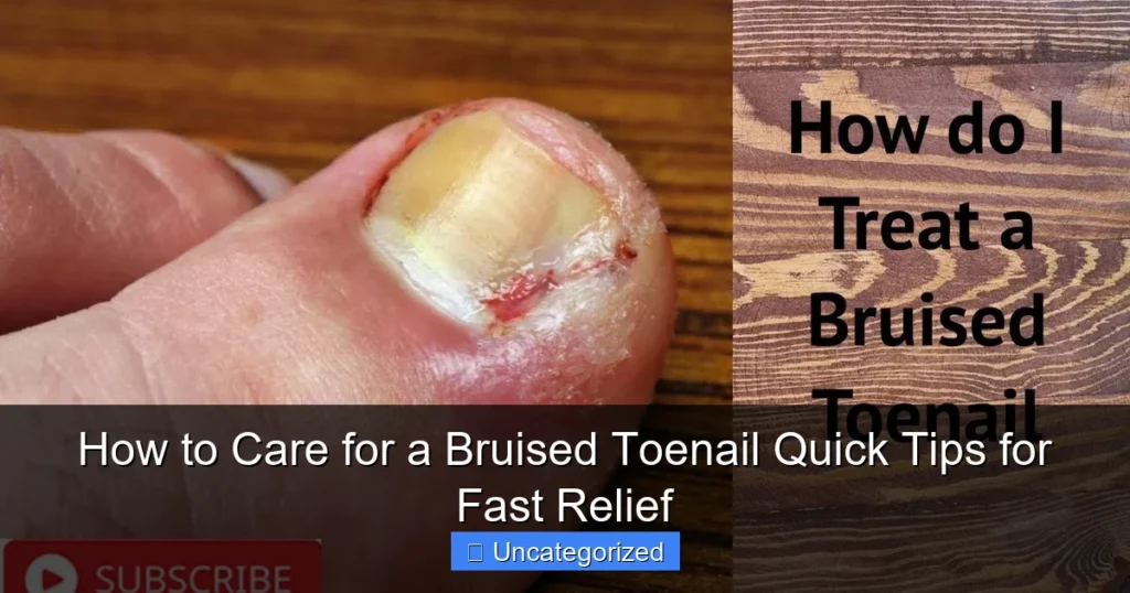 How to Care for a Bruised Toenail Quick Tips for Fast Relief