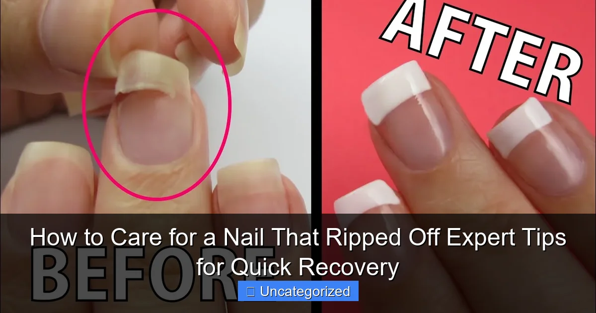How to Care for a Nail That Ripped Off Expert Tips for Quick Recovery