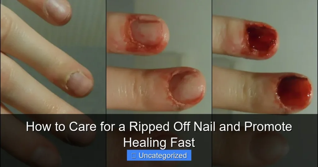 How to Care for a Ripped Off Nail and Promote Healing Fast