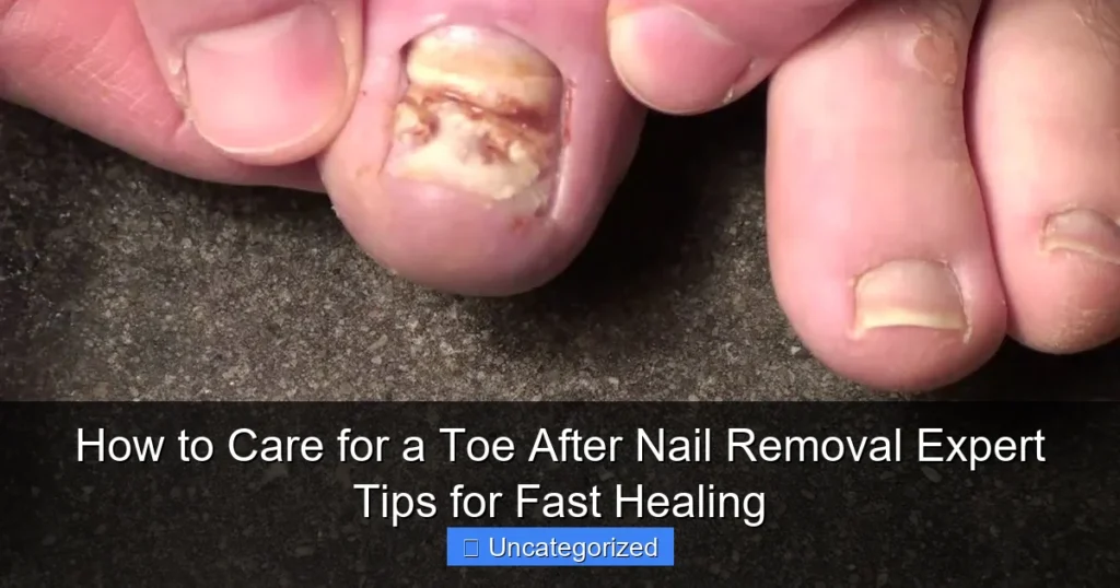 How to Care for a Toe After Nail Removal Expert Tips for Fast Healing