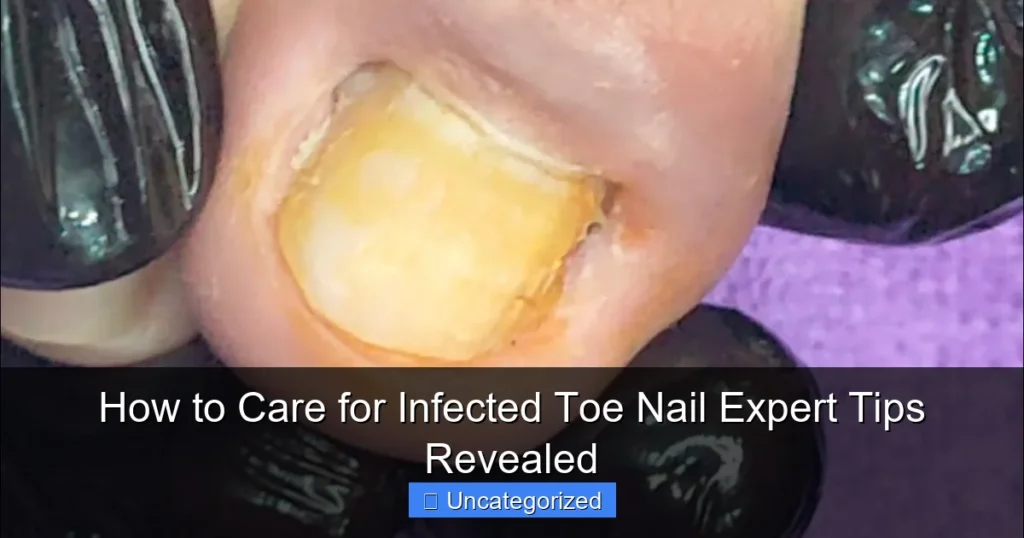 How to Care for Infected Toe Nail Expert Tips Revealed