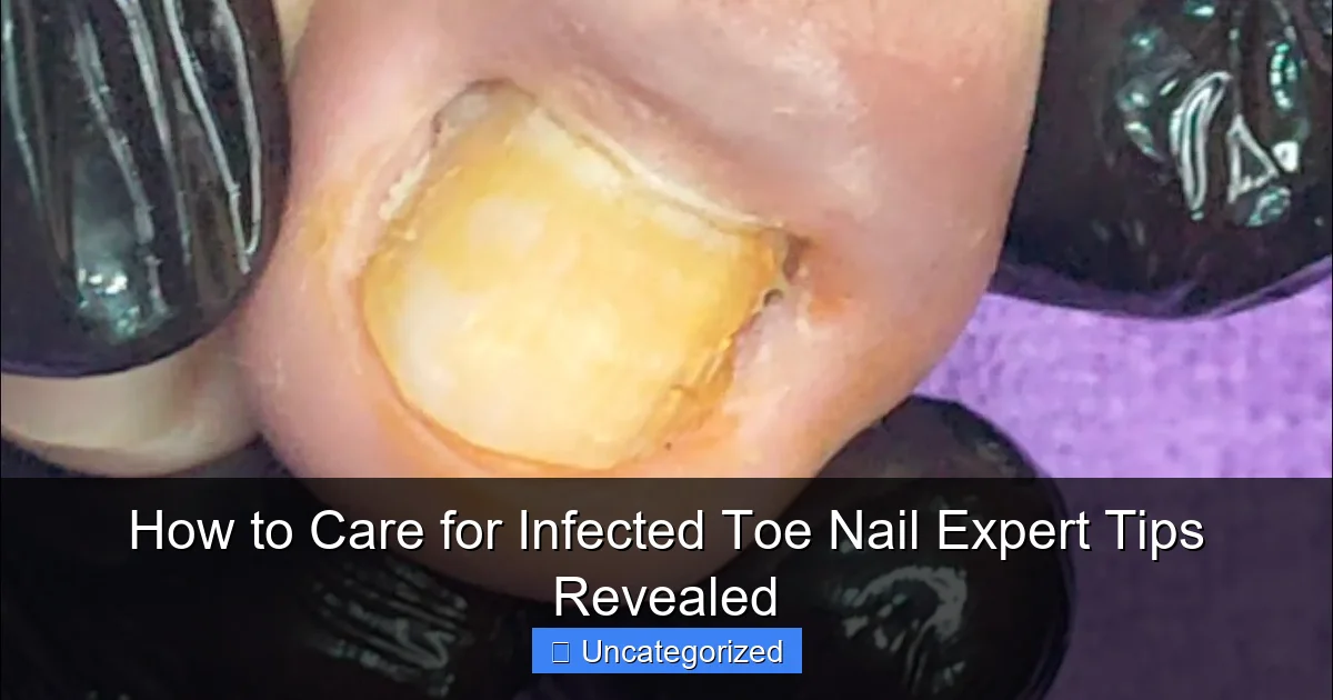 How to Care for Infected Toe Nail Expert Tips Revealed