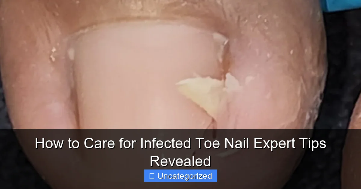 How to Care for Infected Toe Nail Expert Tips Revealed