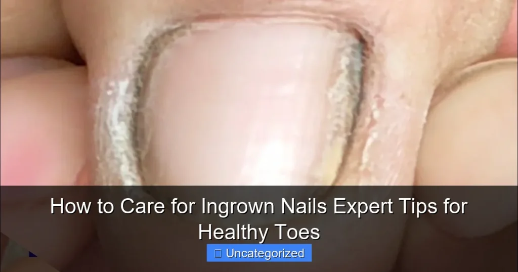 How to Care for Ingrown Nails Expert Tips for Healthy Toes