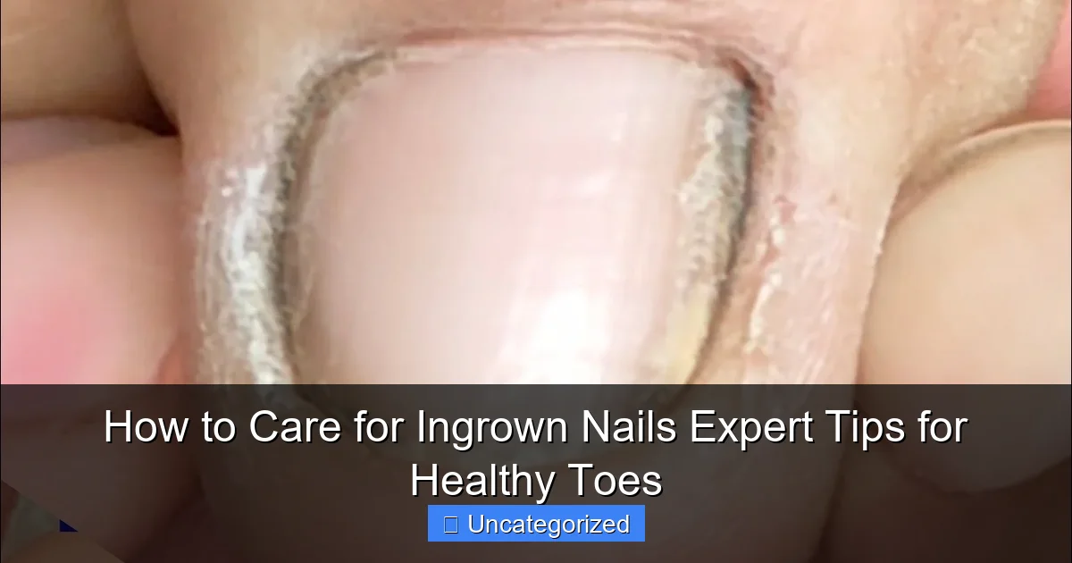 How to Care for Ingrown Nails Expert Tips for Healthy Toes