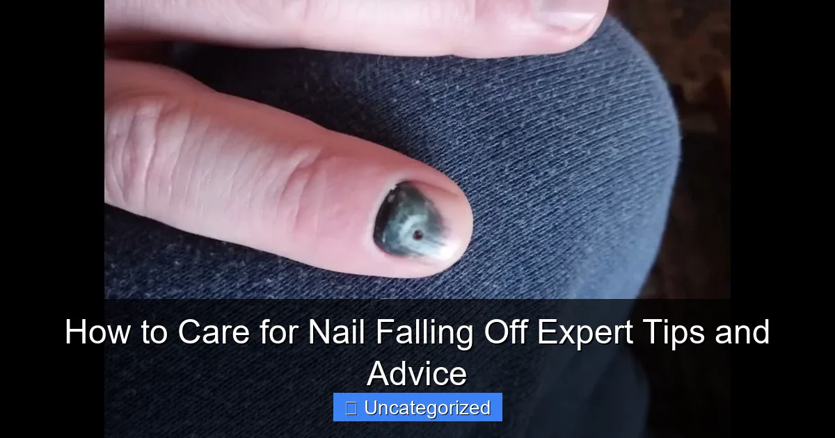 How to Care for Nail Falling Off Expert Tips and Advice