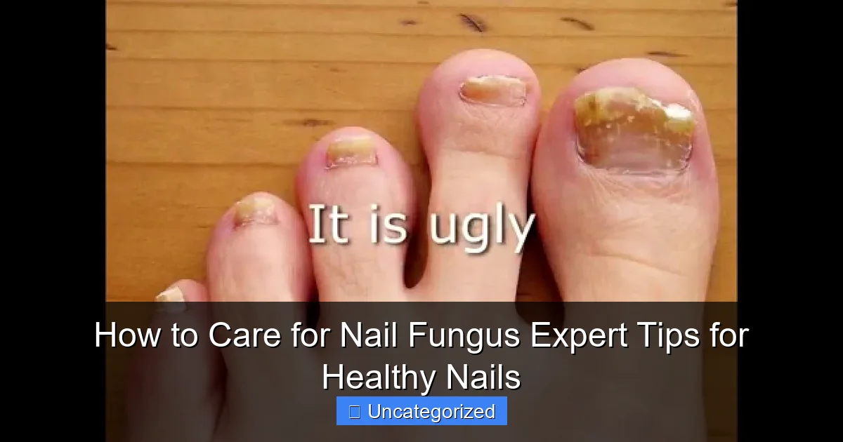 How to Care for Nail Fungus Expert Tips for Healthy Nails