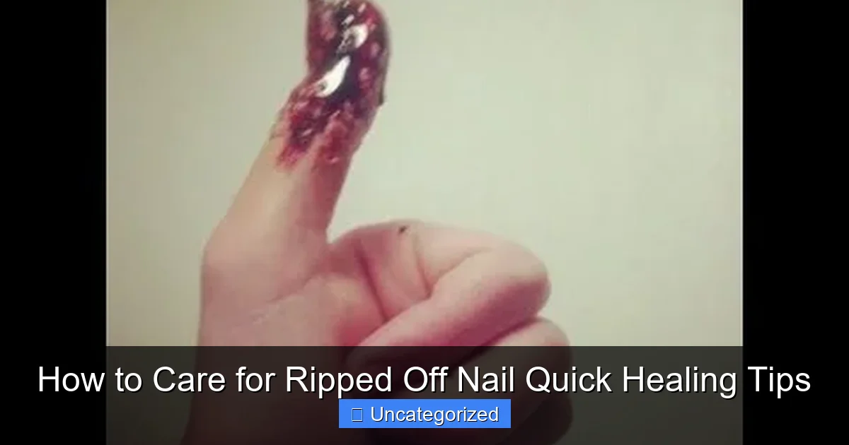 How to Care for Ripped Off Nail Quick Healing Tips