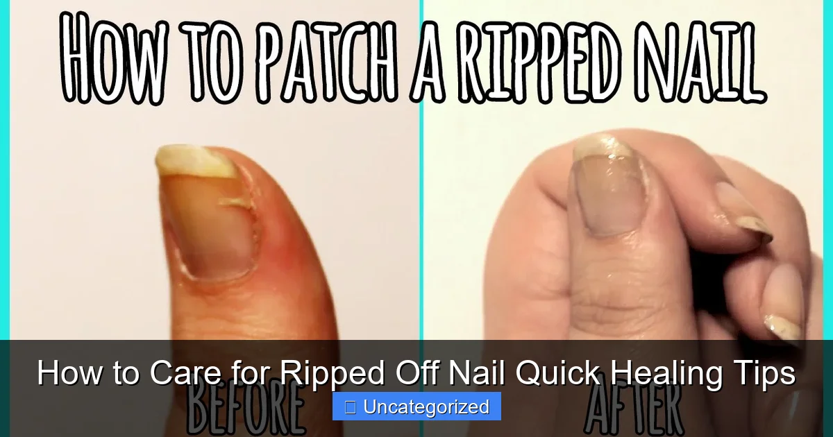 How to Care for Ripped Off Nail Quick Healing Tips