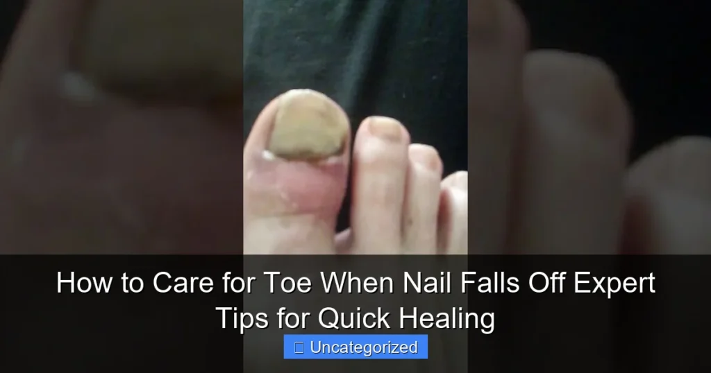 How to Care for Toe When Nail Falls Off Expert Tips for Quick Healing