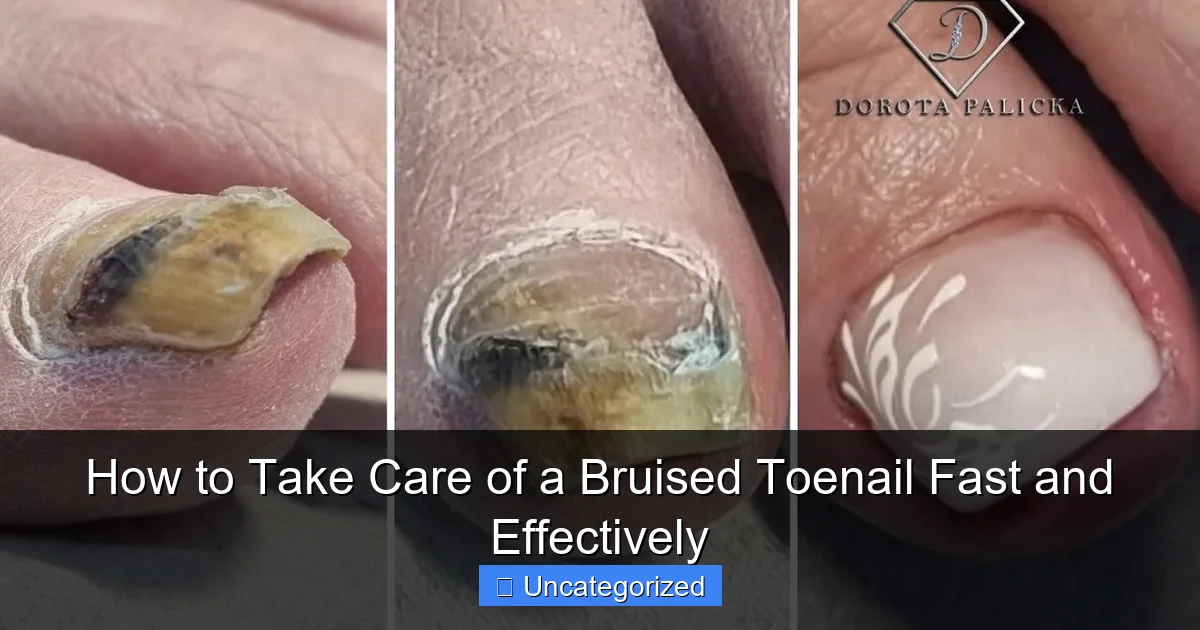 How to Take Care of a Bruised Toenail Fast and Effectively