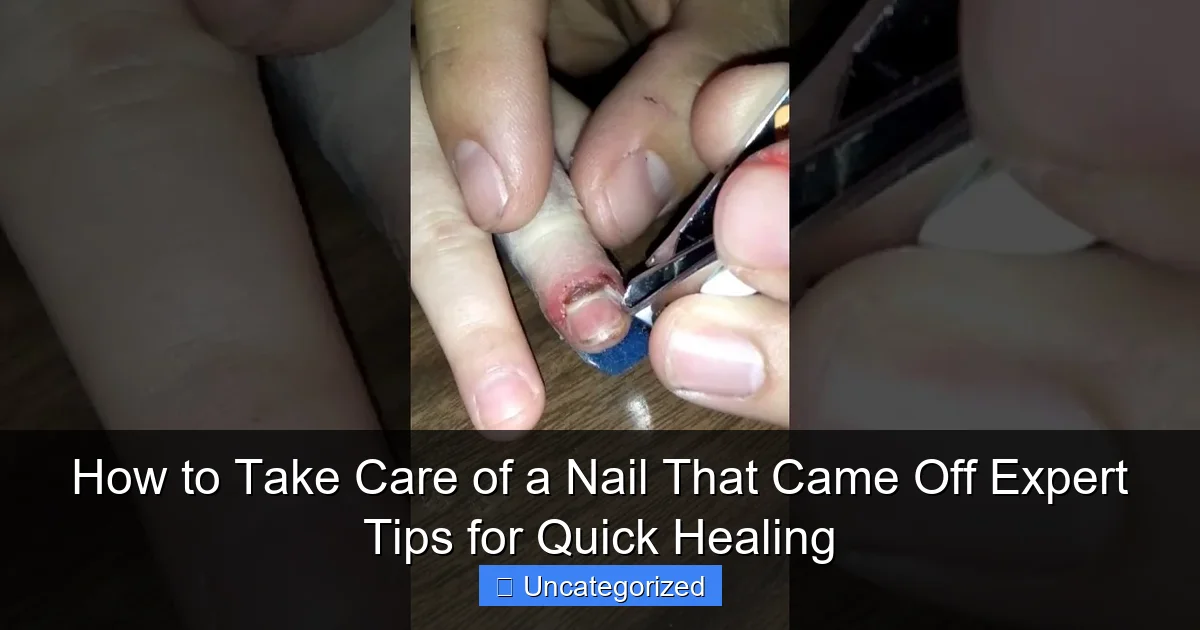 How to Take Care of a Nail That Came Off Expert Tips for Quick Healing