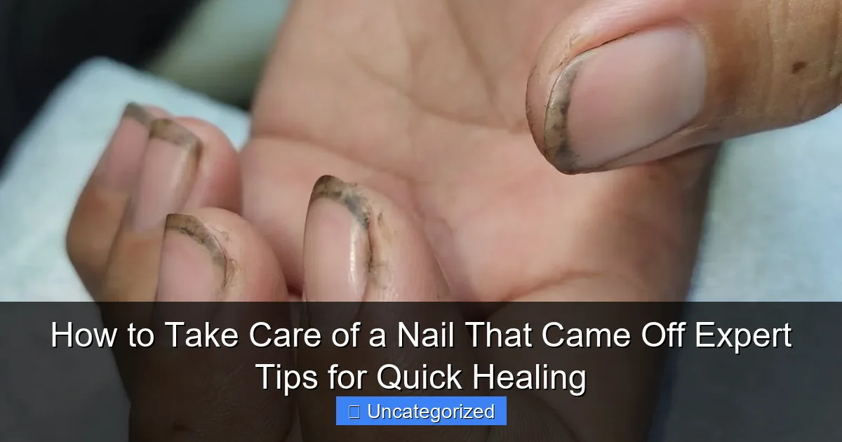 How to Take Care of a Nail That Came Off Expert Tips for Quick Healing