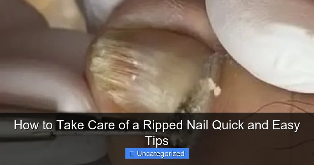 How to Take Care of a Ripped Nail Quick and Easy Tips