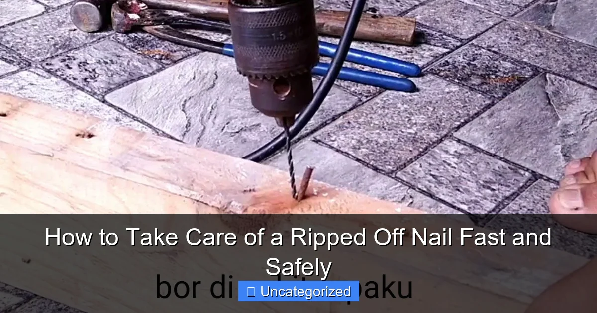 How to Take Care of a Ripped Off Nail Fast and Safely