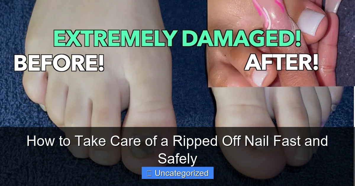 How to Take Care of a Ripped Off Nail Fast and Safely