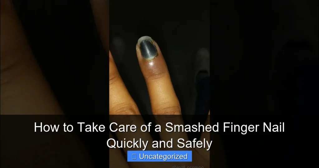 How to Take Care of a Smashed Finger Nail Quickly and Safely