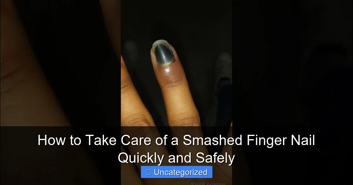 How to Take Care of a Smashed Finger Nail Quickly and Safely
