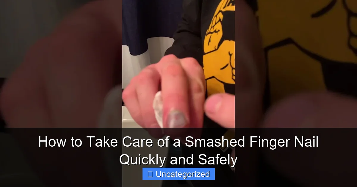 How to Take Care of a Smashed Finger Nail Quickly and Safely