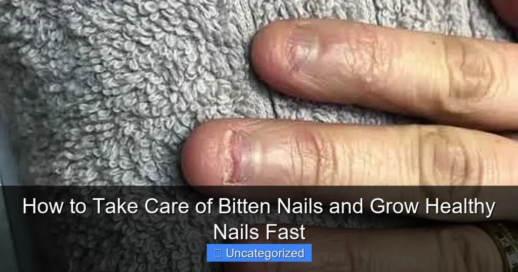How to Take Care of Bitten Nails and Grow Healthy Nails Fast