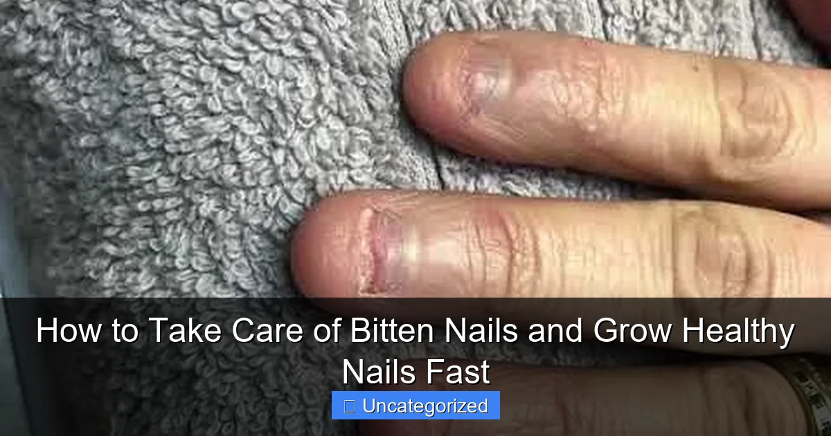 How to Take Care of Bitten Nails and Grow Healthy Nails Fast