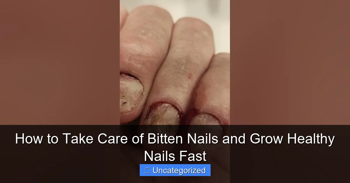 How to Take Care of Bitten Nails and Grow Healthy Nails Fast