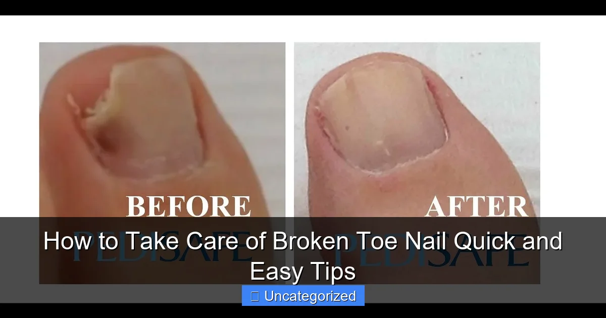 How to Take Care of Broken Toe Nail Quick and Easy Tips
