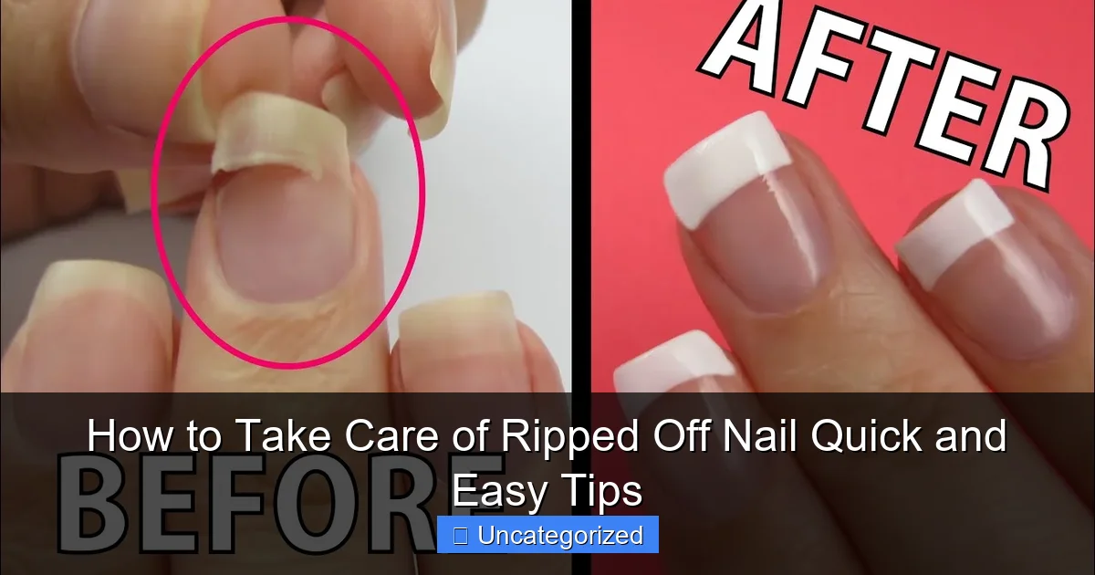 How to Take Care of Ripped Off Nail Quick and Easy Tips