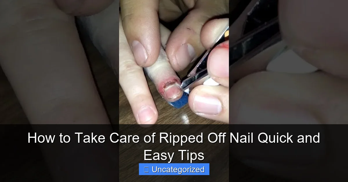 How to Take Care of Ripped Off Nail Quick and Easy Tips